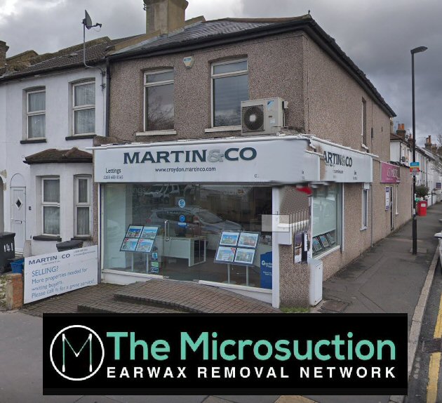 The Pros and Cons of Micro-Suction Ear Wax Removal